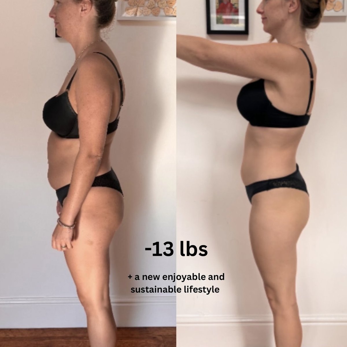 Bite Back client before and after progress photo 6