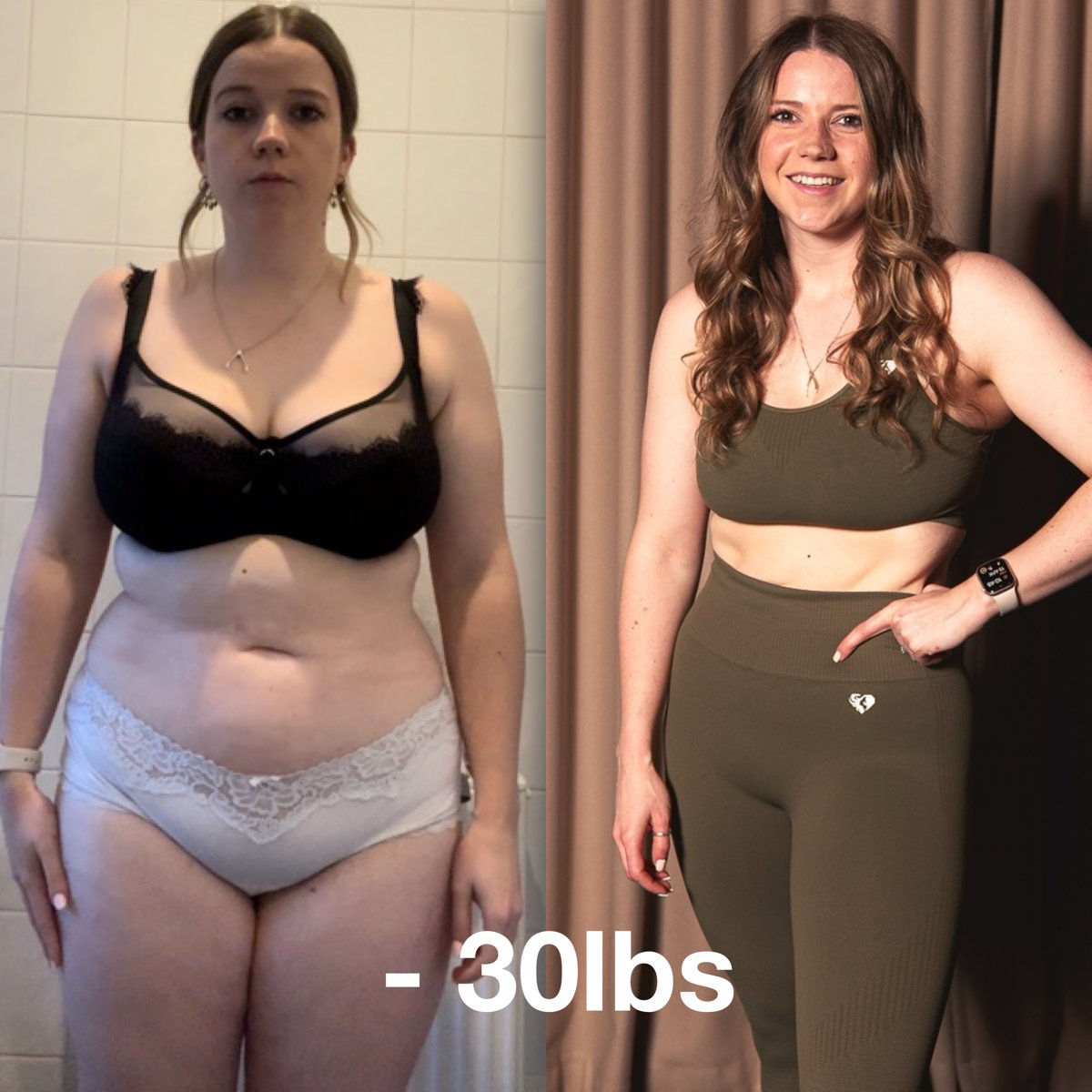 Bite Back client before and after progress photo 12