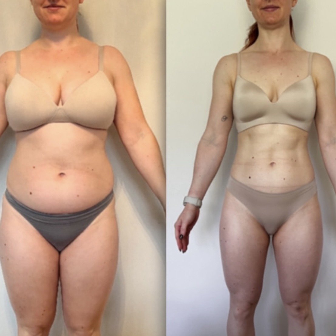 Bite Back client before and after progress photo 10