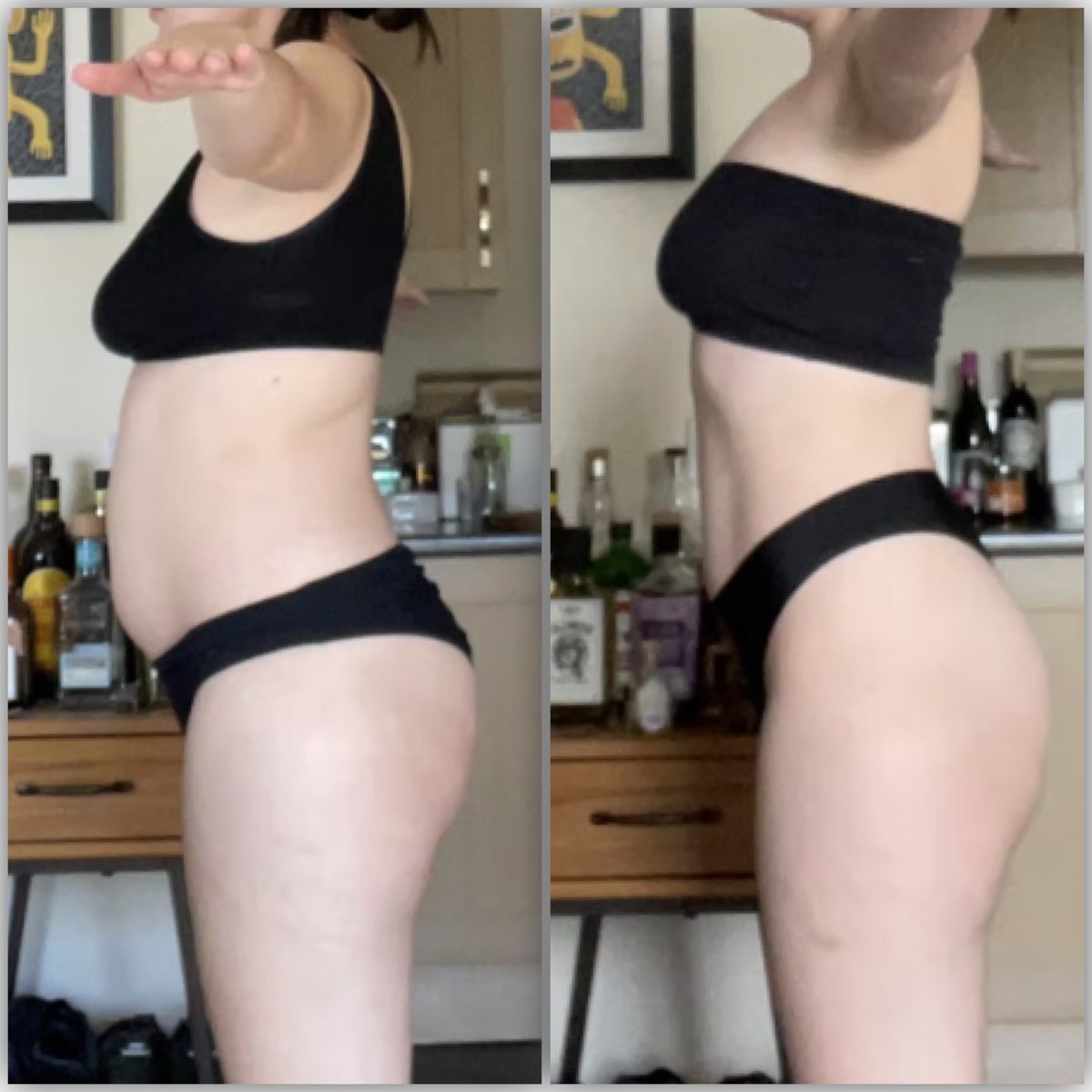Bite Back client before and after progress photo 13