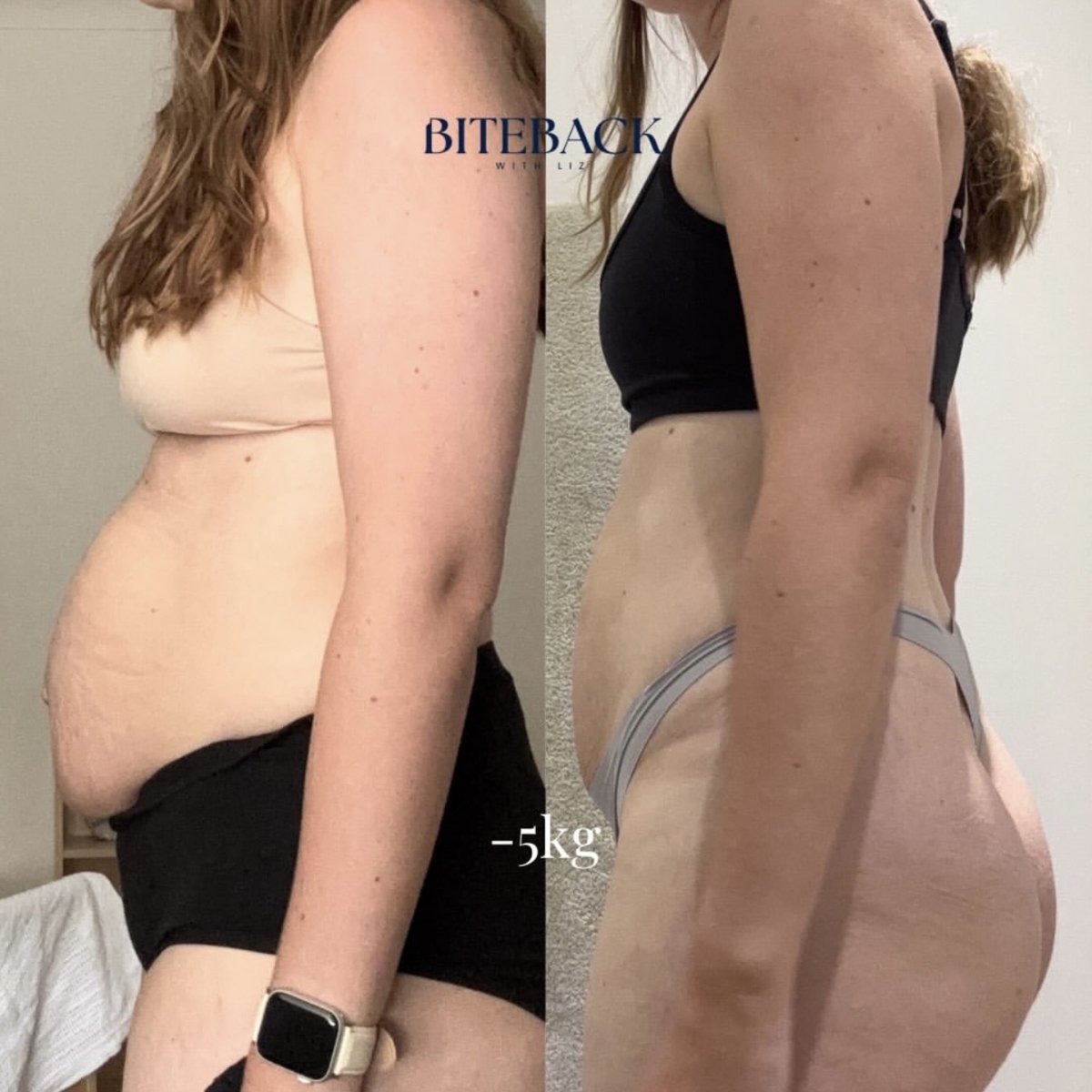 Bite Back client before and after progress photo 2